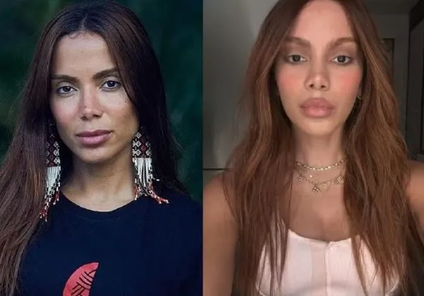 Anitta responde críticas com ironia e reafirma liberdade sobre o próprio corpo