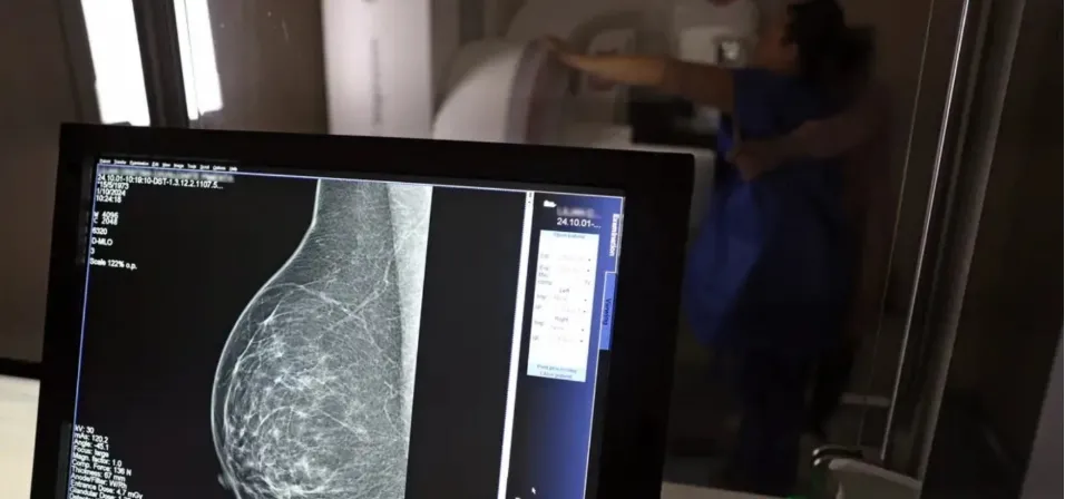 Teste genético BRCA1 e BRCA2 será oferecido pelo SUS
