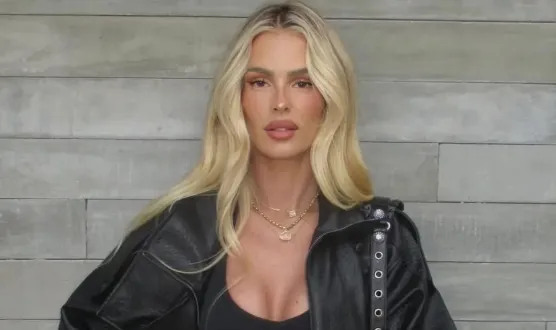 Yasmin Brunet revela diagnóstico de lipedema em relato inusitado 