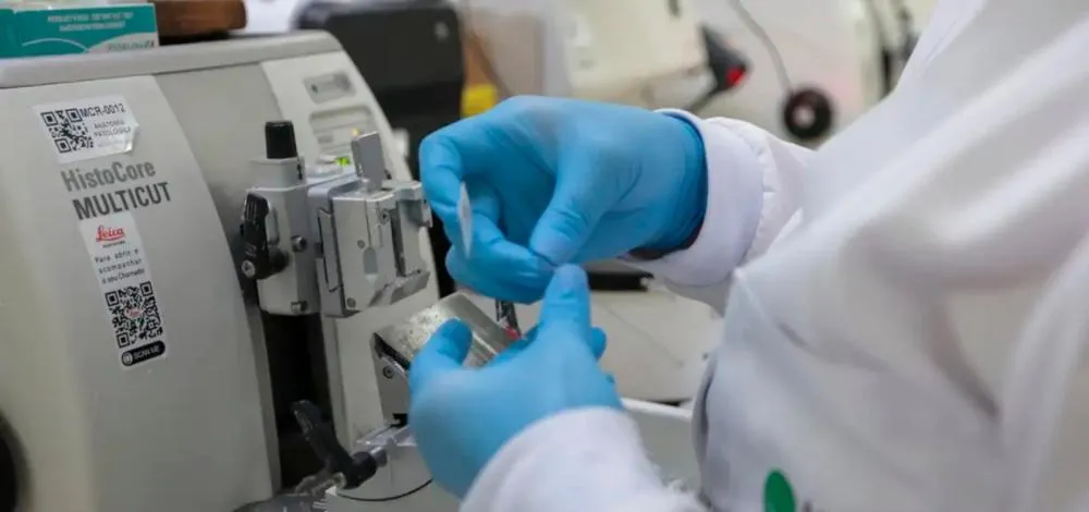 SUS passa a oferecer nova terapia para pacientes com leucemia mieloide aguda