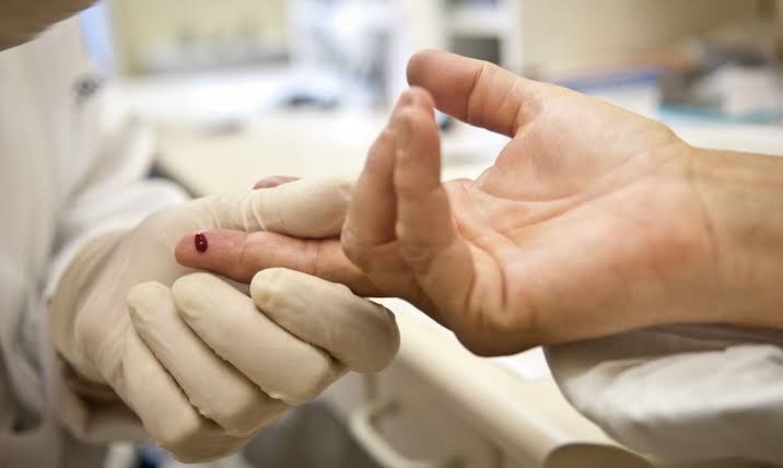 Curada do HIV, mulher argentina é esperança para médicos no combate à Aids