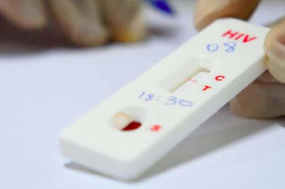 Cientistas afirmam que mulher foi curada do HIV com tratamento de células-tronco