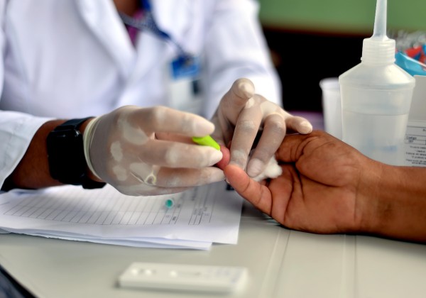 Bahia tem 531 casos ativos e registra mais uma morte