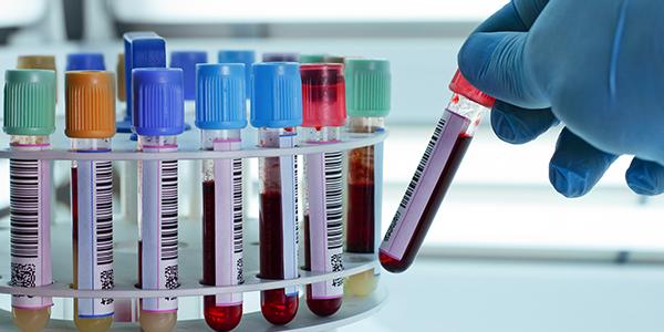 Covid-19 pode ser mais grave em determinados tipos sanguíneos e genes, aponta pesquisa