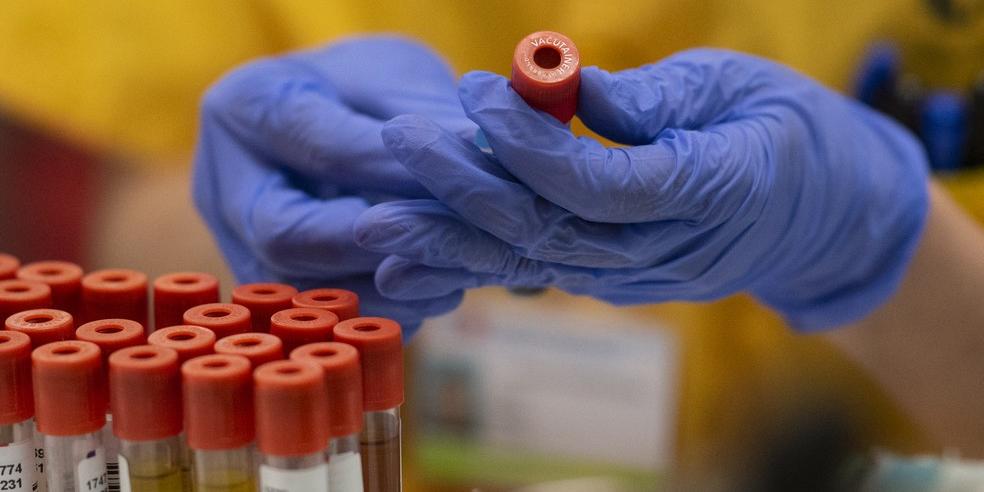 Mata: Boletim Epidemiológico