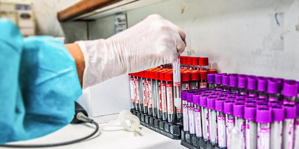 Resfriado comum pode dar imunidade contra a Covid-19, aponta estudo