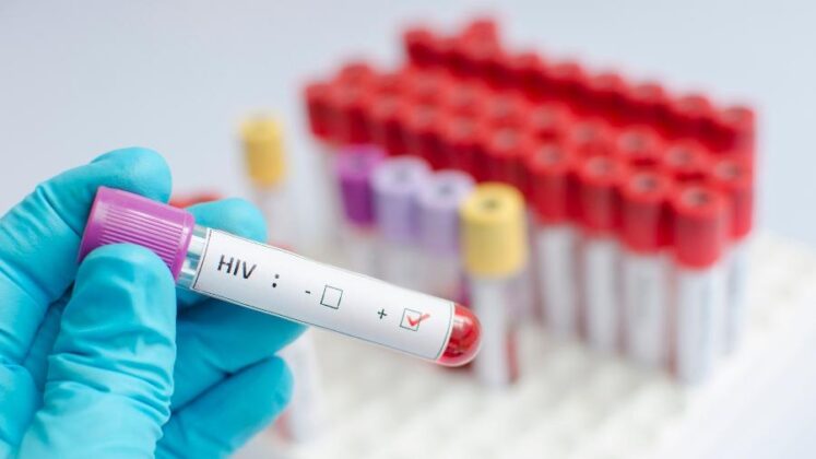 Mulher de 66 anos pode ser 1ª pessoa a se curar do HIV sem tratamento