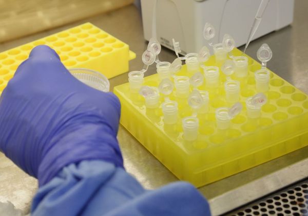 Cloroquina é ineficaz contra coronavírus, diz estudo da OMS