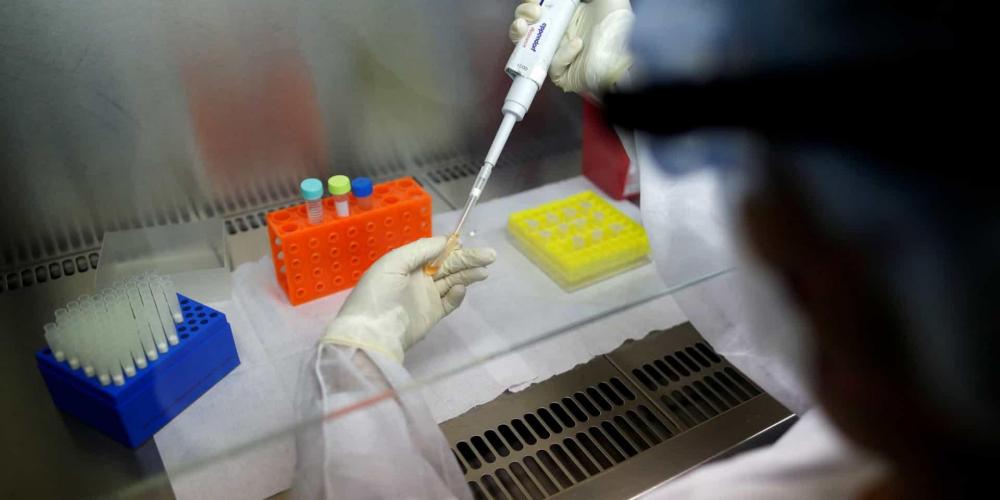 Pesquisadores descobrem vírus raro chapare, causador de doenças como ebola, entre humanos na Bolívia