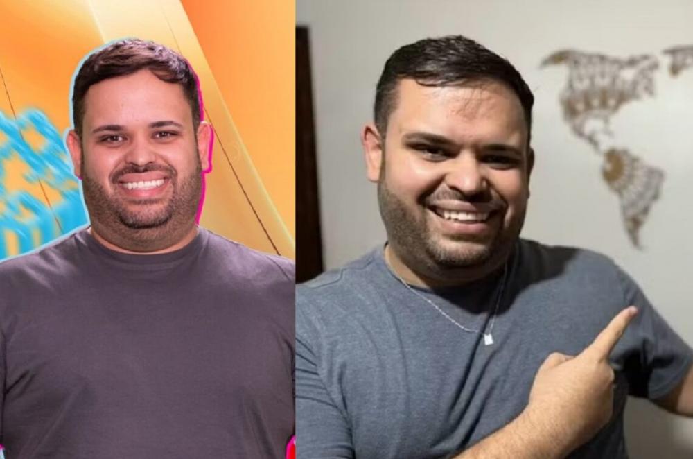 Ex-BBB Michel faz harmonização facial e lipo de papada
