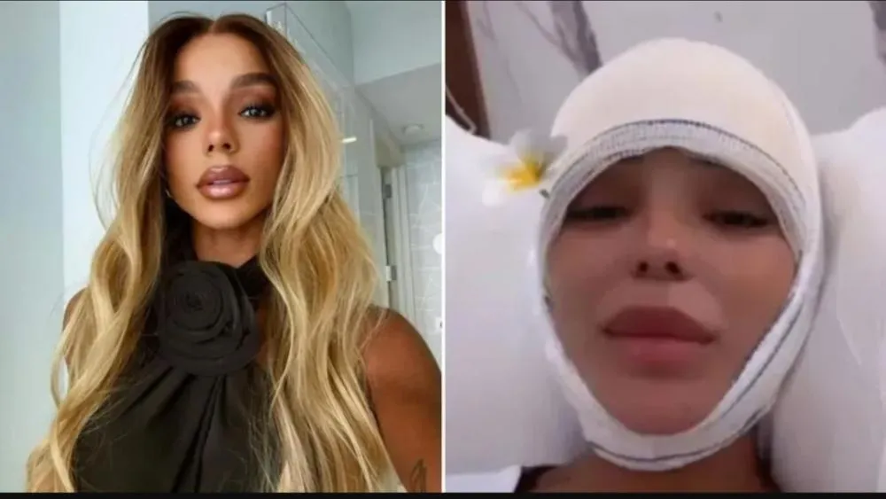 Esposa de Ludmilla reduz testa em cirurgia; saiba detalhes