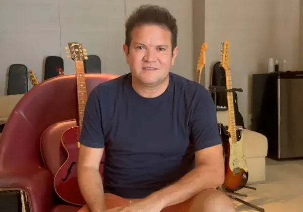 Ximbinha, ex de Joelma, passa por harmonização; veja resultado