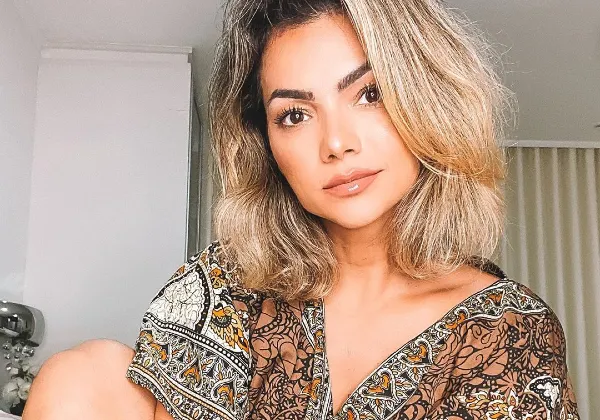 Kelly Key revela diagnóstico de psoríase e fala sobre os desafios da doença