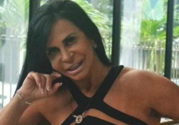 Gretchen aparece sem prótese capilar; confira