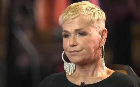 Xuxa revela que fez transplante para tratar doença; saiba mais
