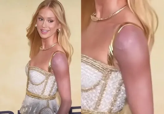 Maria Ruy Barbosa explica hematomas em Cannes